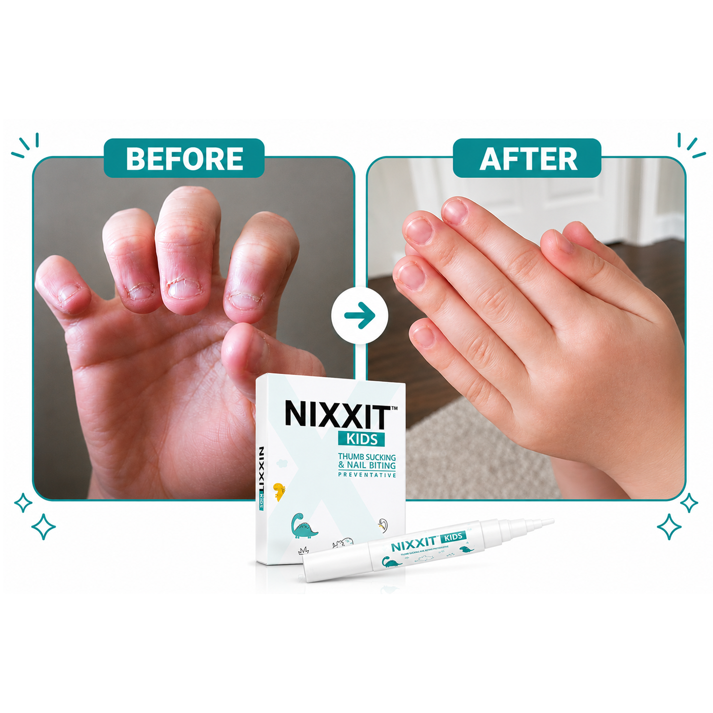 NIXXIT KIDS