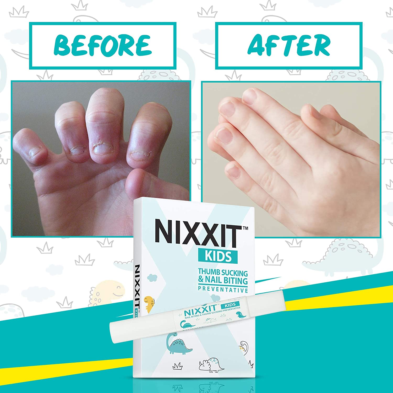 nixxit2