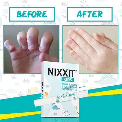 NIXXIT KIDS